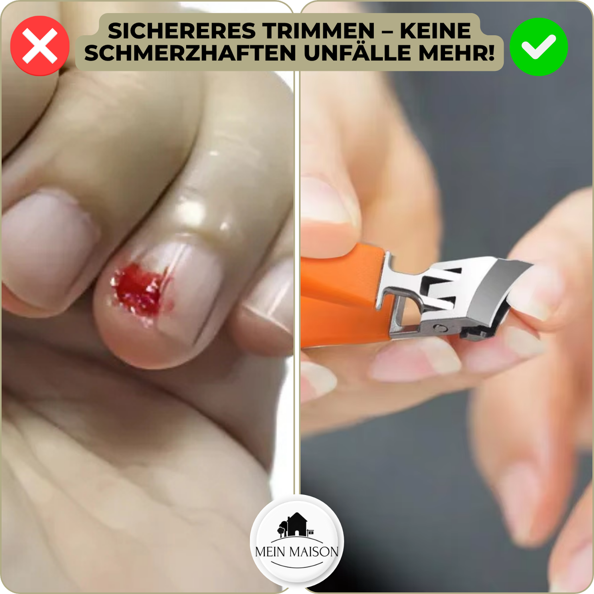 Nagelknipser mit breiter Öffnung – fängt die Späne auf – Bild 5