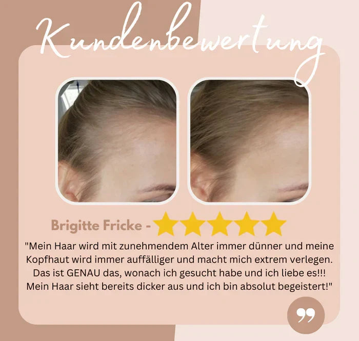 Ansatzpuder für Haarlinie und Bart – in drei Farbtönen – Bild 6